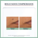 EUCERIN DERMOPURE SERUM TRIPLE ACCION 40ML - Imagen 5