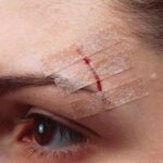 Steri Strip X12 Nexcare - Imagen 2